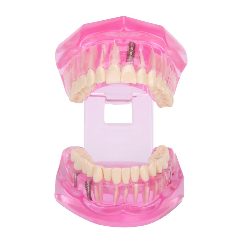 Transparent Adult Teeth Model Pathological Repair Studying Dental Teaching Tools