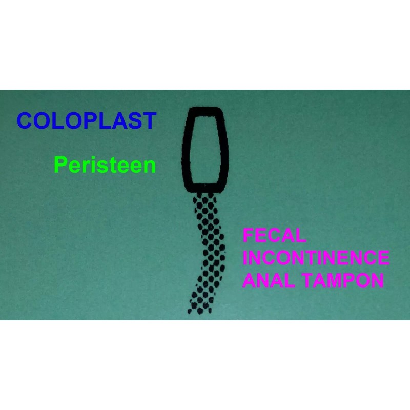 Coloplast (2) Small ENEMA PLUGS Coloplast Peristeen Fecal Incontinence Foam