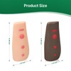Ultrassist Tuberculosis(TB) Test Palpable Arm Set - Realistic Dual-Tone Training