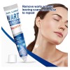 # Aq Crema Eliminadora De Verrugas 20 G - Para