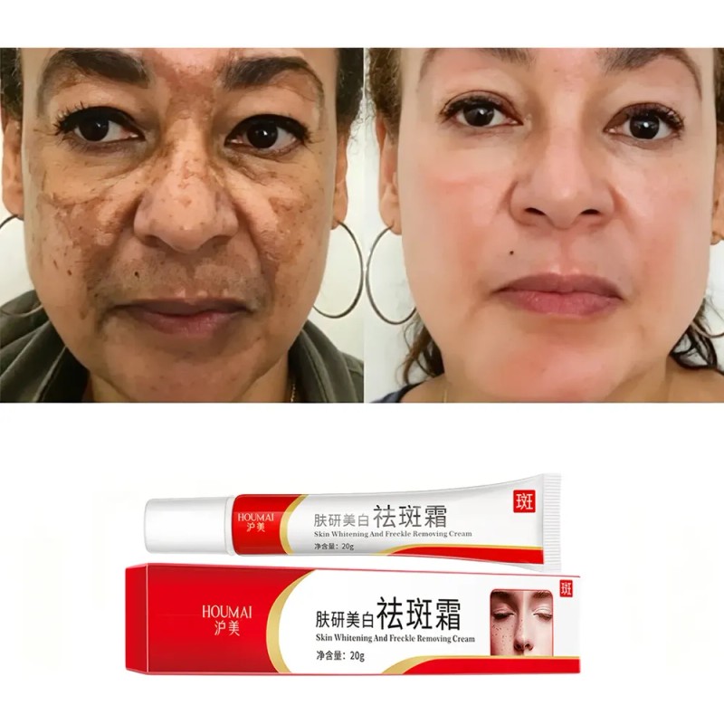 Crema Facial Despigmentante Houmai 20g Todo Tipo De Piel