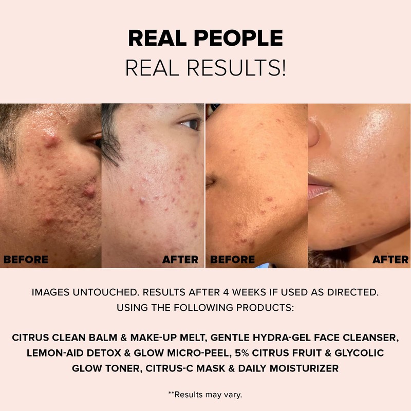 LEMON-AID DETOX & GLOW MICRO-PEEL