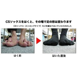 sanwaherusudezain konfo-tosapo-tosokkusu Regular Type Bunions, Toothpick Holder Chain, Sports, Style Up to Effectively , , , blk,