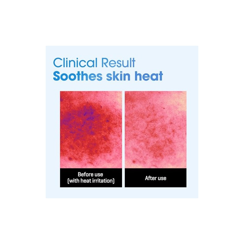 Some by Mi Beta-panthenol Repair Daily Mask - 30 Sheets,