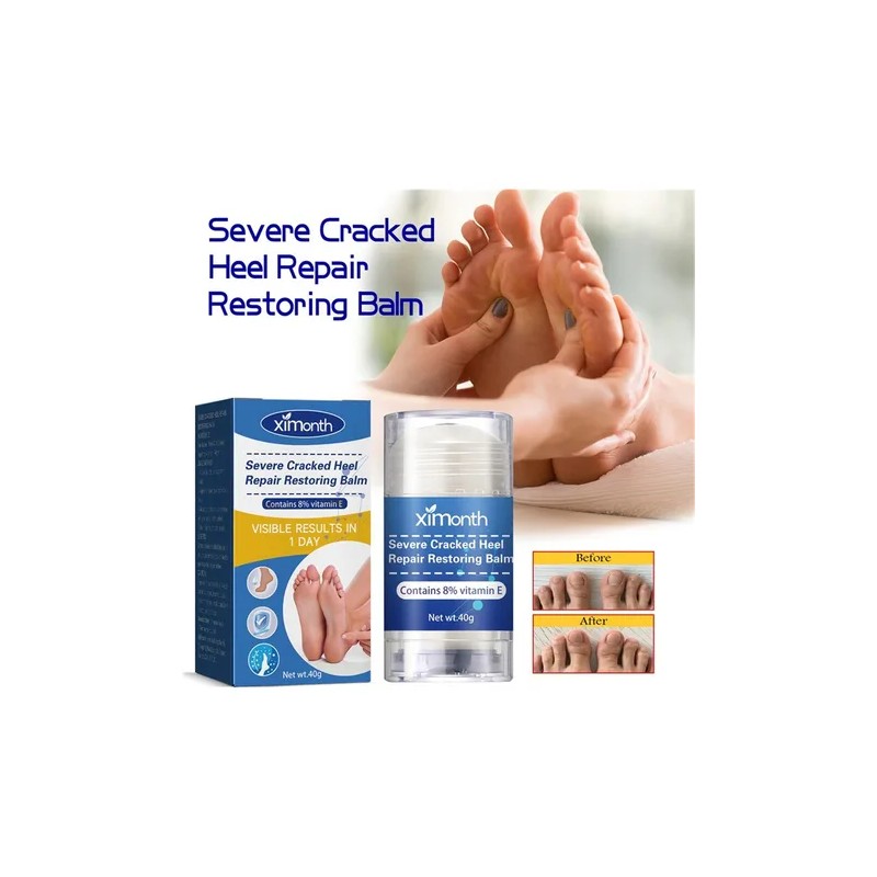 2×crema Reparadora Grietas Secas Y Talones For Pies Y Mano