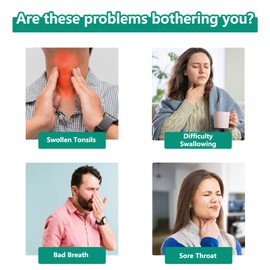 Tonsil Stone Remover with Oral Rinse Liquid to Soothe Tonsils, and Freshen Breath & Alcohol-Free – 300ml (10.14 fl oz)