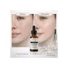 Serum V-tranex Despigmentante Acido Tranexamico Mancha 30ml Todo Tipo De