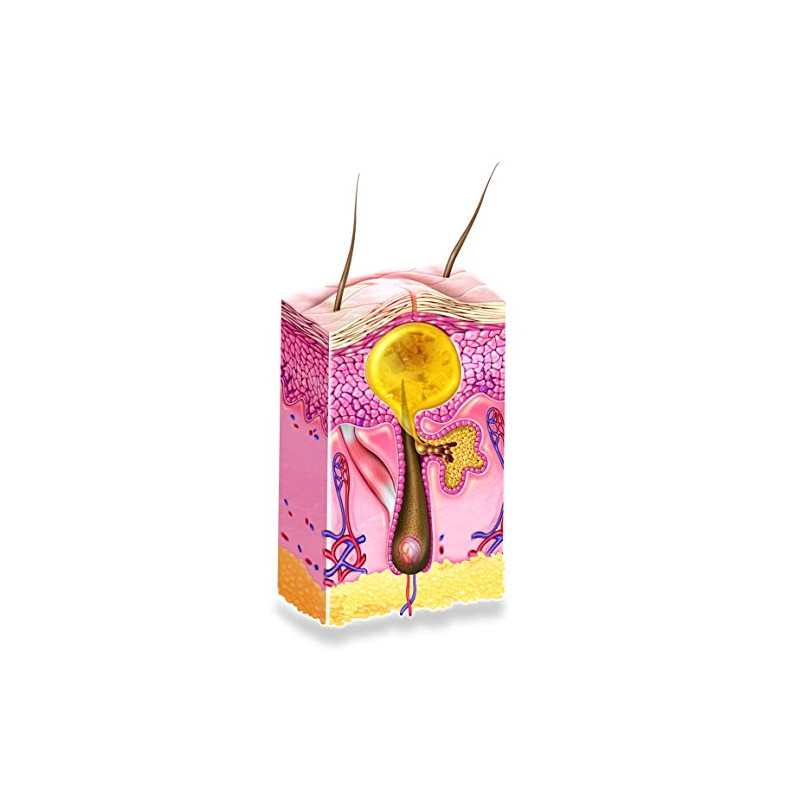 Isispharma Teen derm Alpha Pure 30 ml, tratamiento para acne