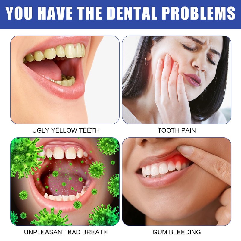 Hydroxylapatit Zahnpasta,Hydroxyapatite Toothpaste,Probiotika Hydroxylapatit Zahnpasta Ohne Fluorid,Aufhellung Zahnpasta mit Hydroxylapatit,Tiefenreinigung,Langanhaltend