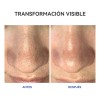 Mascarilla Dr.leo Limpiadora Poros Profundos