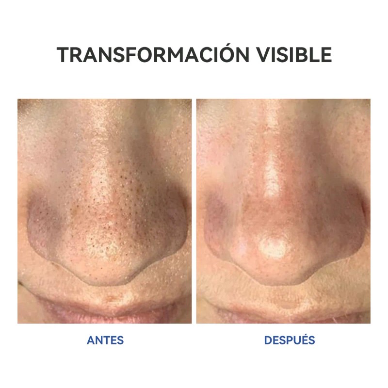 Mascarilla Dr.leo Limpiadora Poros Profundos