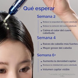 ViveLab Suero De Microagujas Para El Cuero Cabelludo  Tratamiento K-Beauty Para El Crecimiento Del Cabello Y El Cuero Cabelludo Con Spioxyl 400