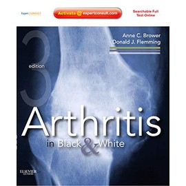 Arthritis in Black and White