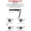 Hedgehog Gutter Clips Pack of 10, Keeps Gutter Brush in