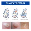 Líquido Mejorador De Verrugas Y Maíz Reva