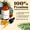 Aceite De Batana Orgánico Natural Crecimiento Del Cabello