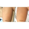 Nefertiti Aclarador De Vello Facial Y Corporal Aclaran-t