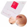 1pz Cosrx Acné Pimple Master Patch Original(24 Parches) Tipo De