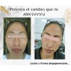 Crema Aclaradora Quita Manchas Paño Y Sol Melasma Todo Tipo