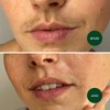 NAD's 20 Piece Facial Wax Strips
