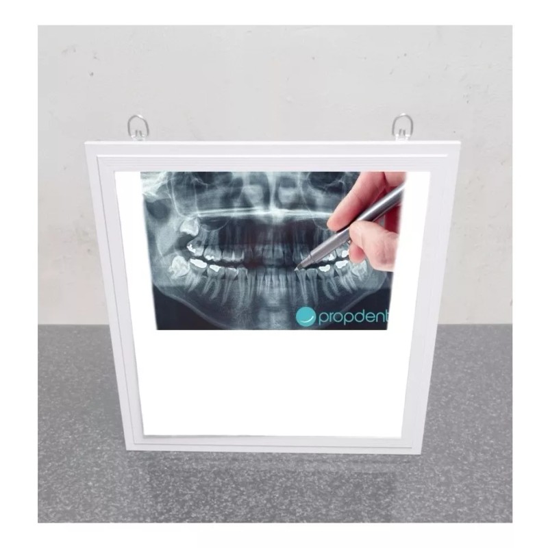 MMC-INGENIERIA MEDICA Negatoscopio Dental Led 30 X 30 Ultra Slim
