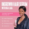 Divine Derriere Razor Bump Stopper 2 Care For Ingrown Hair