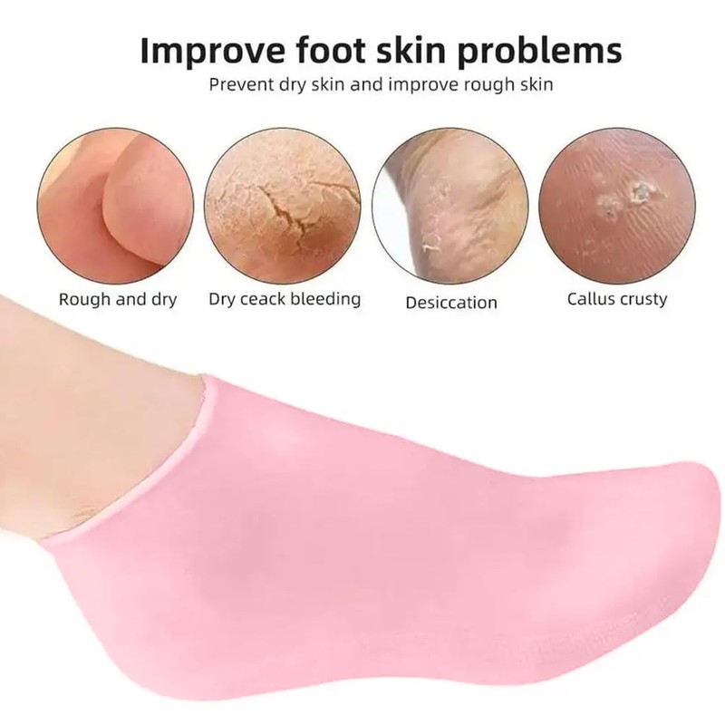 SGERUFZ 3 Paar feuchtigkeitsspendende Gelsocken und Silikonhandschuhe Gelsocken für die