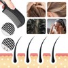 ExcellaElite Scalp Comb for Dandruff Removal 3 Pcs Scalp Sweep