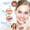 Teeth Whitening Essence Pen - Reduces Teeth Stains and Yellowing,