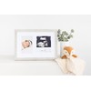 Kate & Milo Rustic Bracelet ID and Sonogram Frame, Rustic