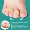 Welnove Gel Toe Separator - 8 Pack Pinky Toe Spacers