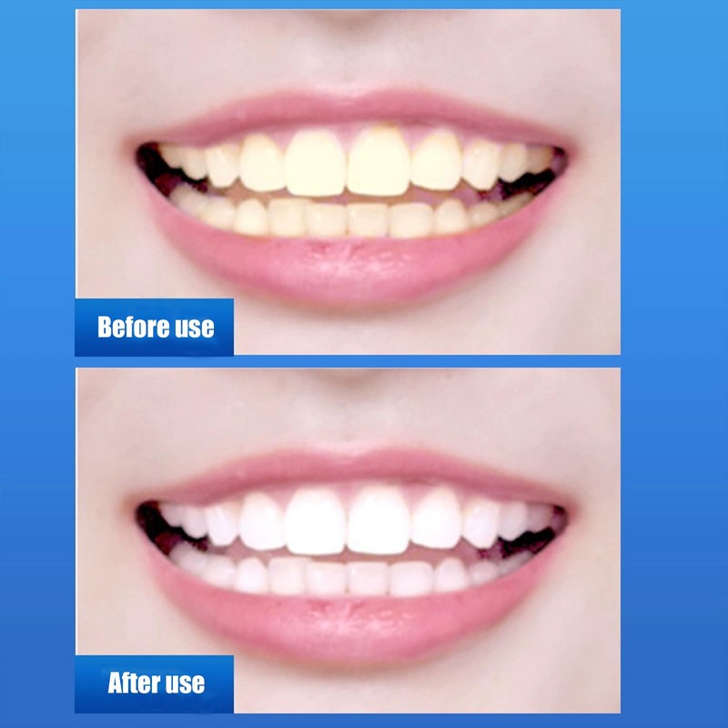 RIBHNXHI Teeth Whitening Strips - 28 Strips (14 Sets) Enamel