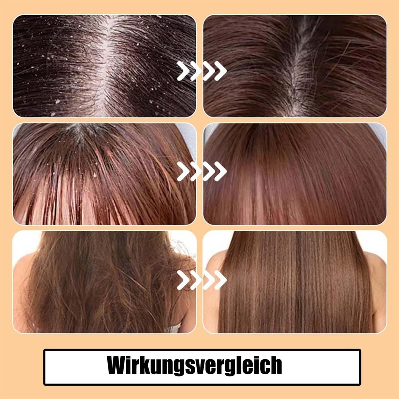 Pack of 3 dandruff comb, lice comb, human lice comb,