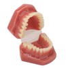 Tooth Model 28 Teeth Dental Orthodontic Model Teaching Study Supplies