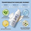 Butt & Thigh Acne Cream – Fast Acting Exfoliating Body
