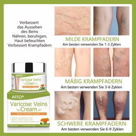 Varicose Veins Cream, AFFO Varicose Veins Cream Against Spider Veins, Varicose Veins Cream, Anti Varicose Veins and Spider Veins Cream, Legs Care Ointment (50 g)