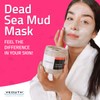 YEOUTH Dead Sea Mud Masks for face with Hyaluronic Acid,
