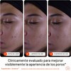 Limpiador Facial Exfoliante Superfruit 145 ml para Iluminar y Suavizar