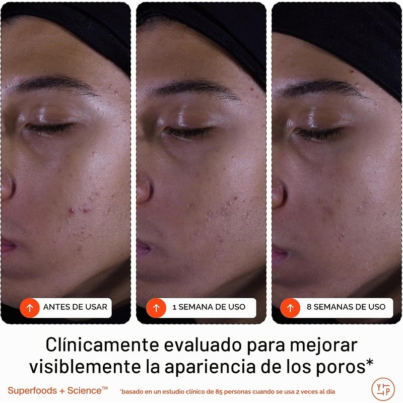Limpiador Facial Exfoliante Superfruit 145 ml para Iluminar y Suavizar