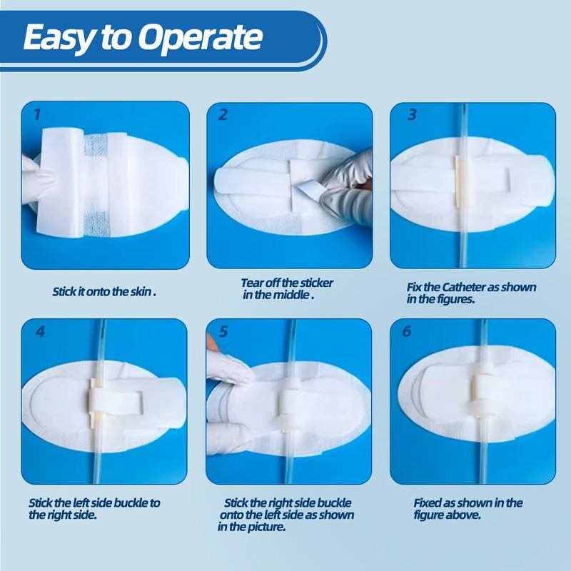 Catheter Stabilization Device, Extra Large Catheter Leg Bag Leg Strap