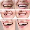 2 Pairs Temporary Smile Support Adjustable for All Genders -