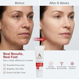 Alpha Skin Care - Enhanced Renewal Cream, 12% Glycolic AHA, Real Results for Lines and Wrinkles| Fragrance-Free and Paraben-Free| 2-Ounce
