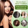 YOFDAL 2 Pezzi Shampoo solido bio Anticaduta, Shampoo Crescita Capelli