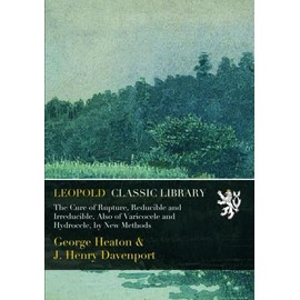 The Cure of Rupture, Reducible and Irreducible, Also of Varicocele and Hydrocele, by New Methods