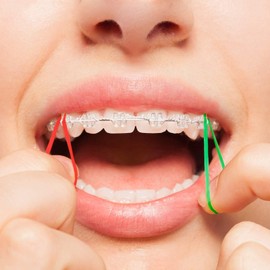 JMU Orthodontic Elastics 3/16 Medium 4.5oz, 500 pack Orthodontic Rubber Bands, Neon, Latex Free, Made in USA