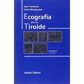 Ecografia della tiroide