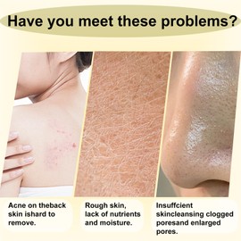 Lemon Turmeric Soap For Women- Turmeric Soap Bar For Acne Dark Spots Blackheads Soap- Dark Spot Corrector Remover,Acne Remover, Cleanses, Smooth Skin Soap Bar- Moisturizing Soap for Face and Body