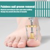 60 Pieces Painless Toenail Smoothing Strips with Nail Remover +
