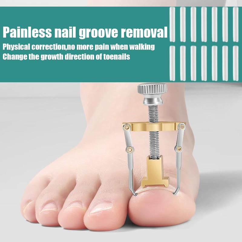 60 Pieces Painless Toenail Smoothing Strips with Nail Remover +