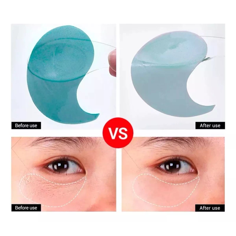 Lanbena Parches Lanbena Mascarilla De Ojos Ácido Hialurónico Full